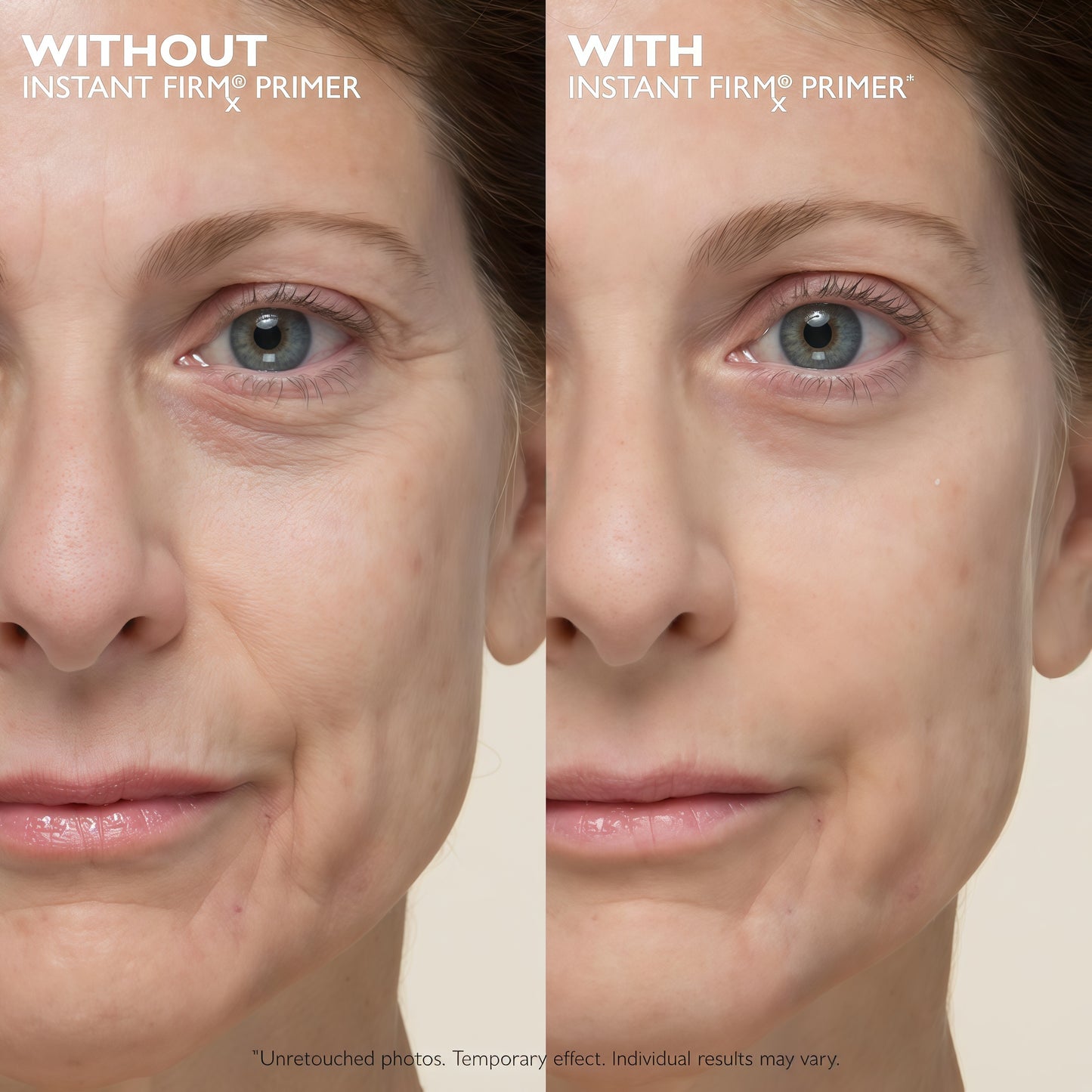 Peter Thomas Roth |Instant FIRMx Temporary Face Tightener